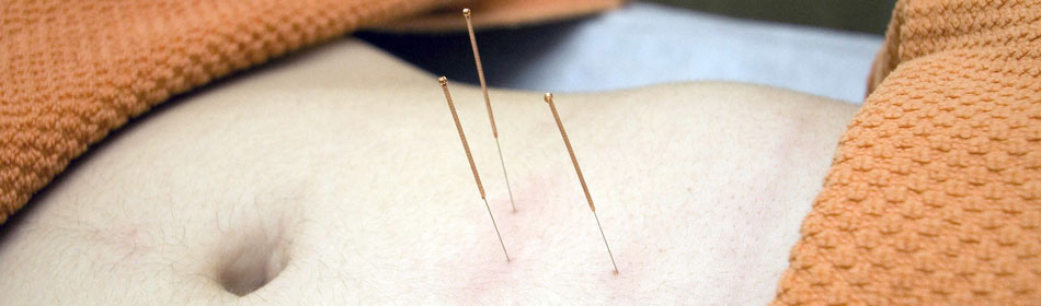Accupuncture, Eastern Healing Arts in the Horsham, Montgomery County PA area